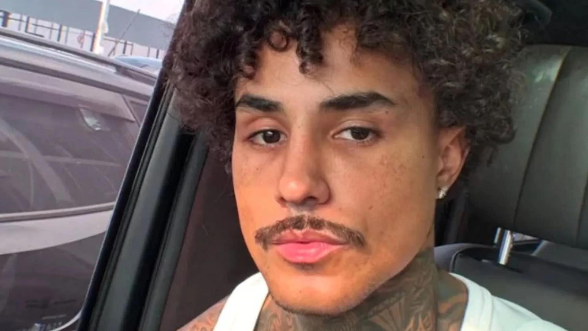 MC Livinho é liberado da UTI e celebra recuperação após acidente de trânsito