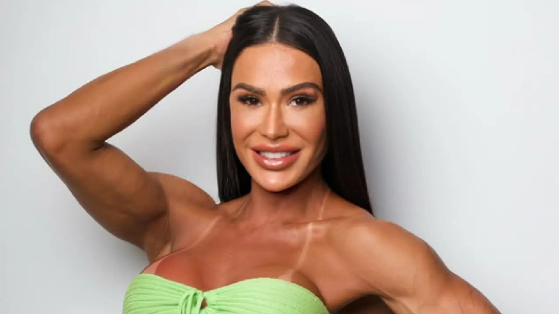 Gracyanne exibe cicatriz no joelho após se lesionar e passar por cirurgia