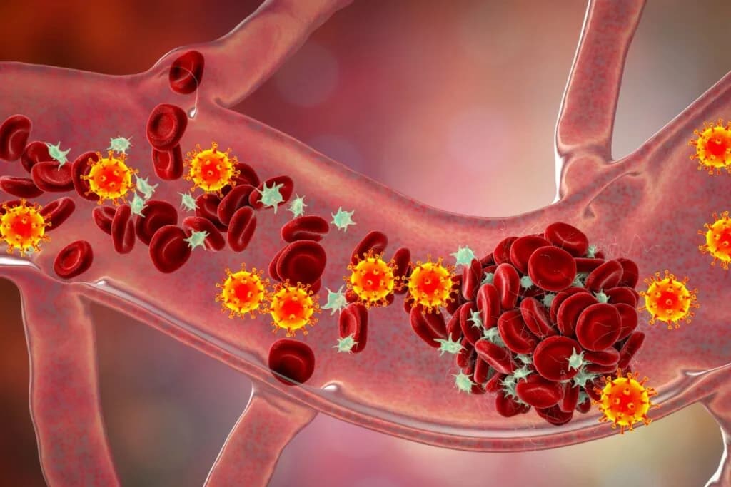 Entenda como a predisposição genética aumenta o risco de trombose