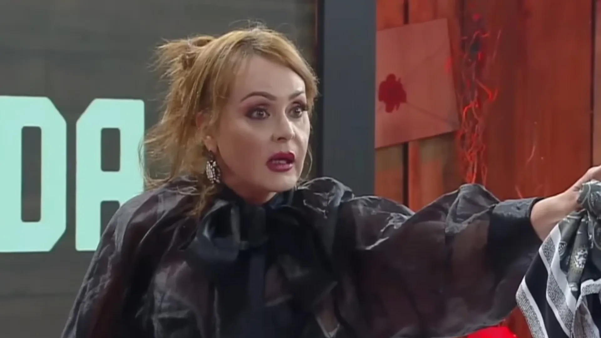 Gaby Spanic faz harmonização facial e exibe resultado