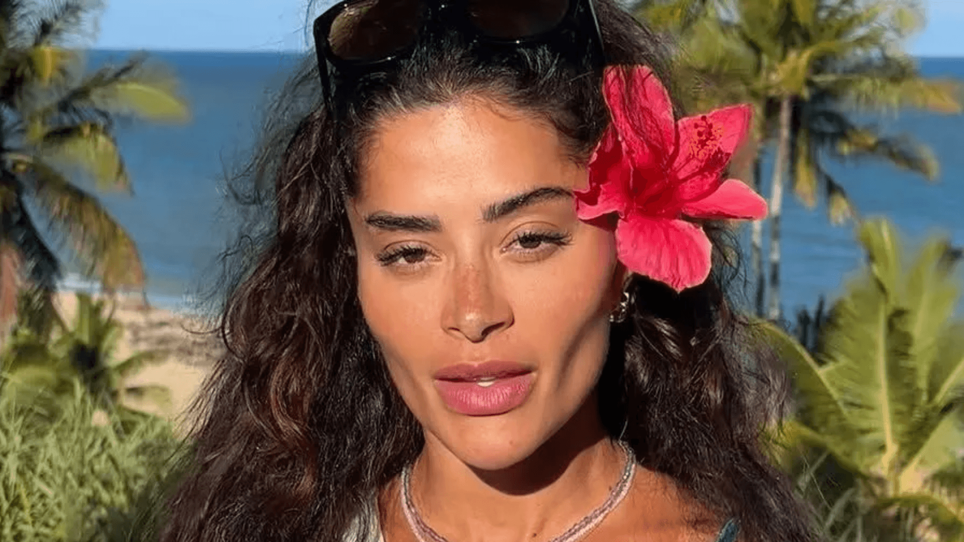 Aline Campos surge pela primeira vez após cirurgia no rosto