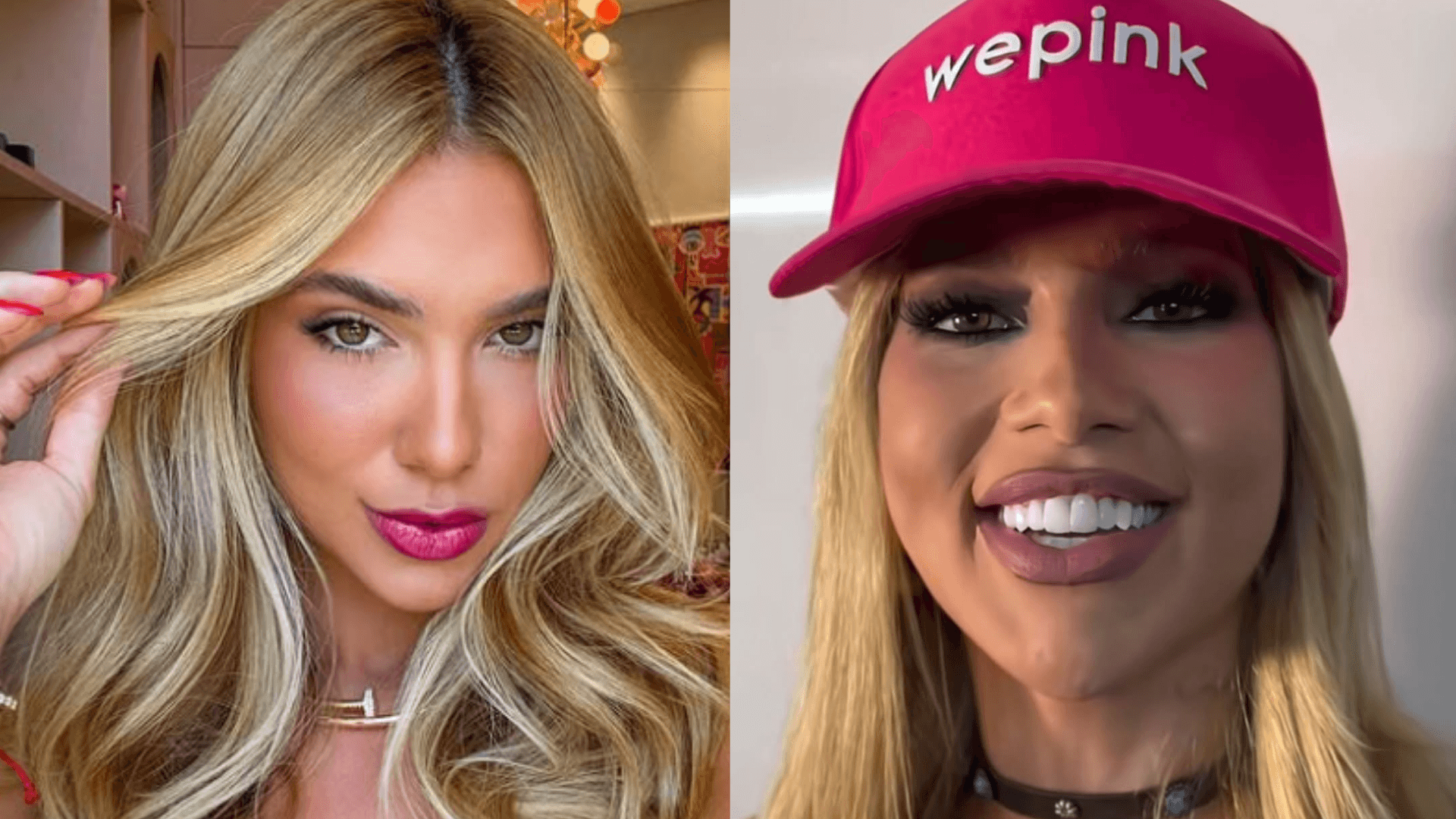 Virginia rebate críticas e nega novos procedimentos estéticos