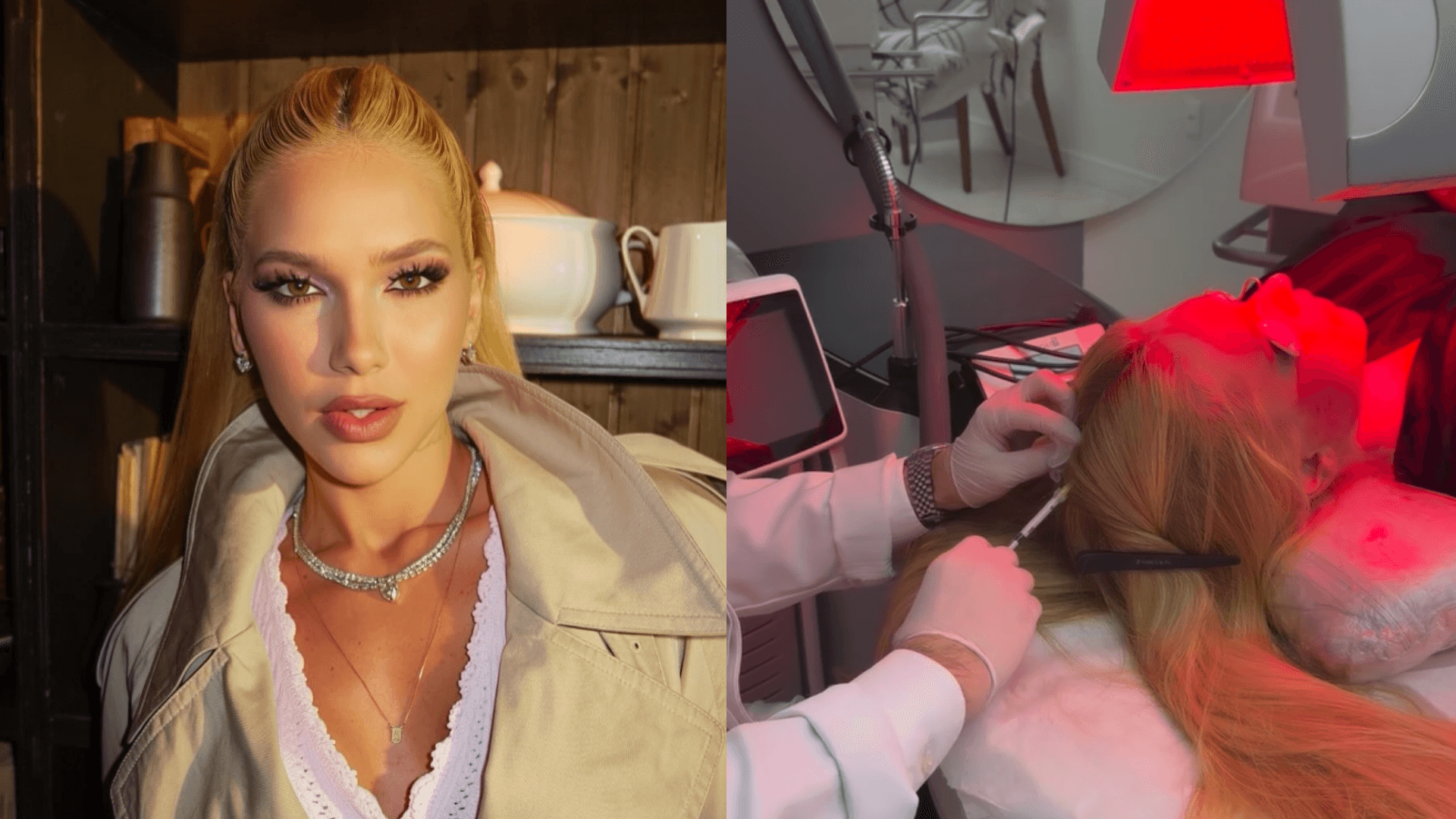 Virginia Fonseca compartilha diagnóstico de alopecia: “Vou tratar e vai dar certo”