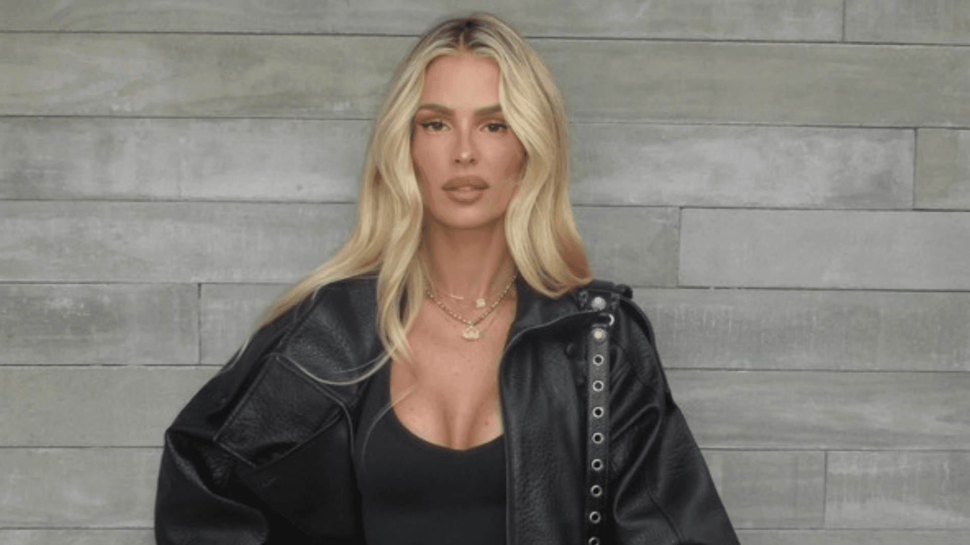 Yasmin Brunet conta diagnóstico inusitado envolvendo lipedema