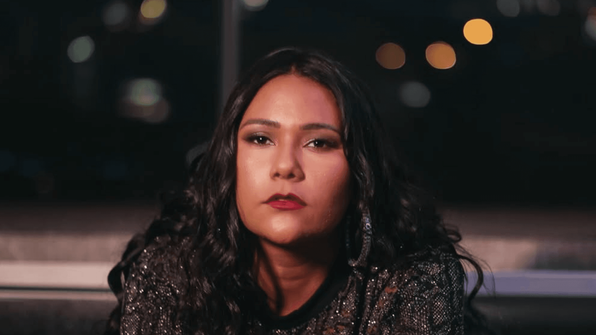 Chaiany passa por procedimento estético facial e explica motivo: “Afinar meu rosto, porque ele é muito grandão”