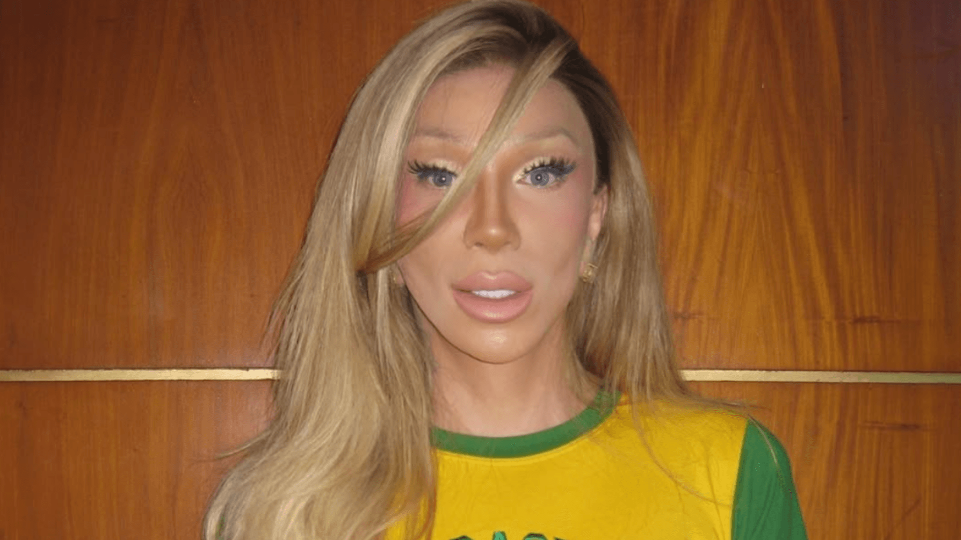 Maya Massafera mostra rosto uma semana após peeling