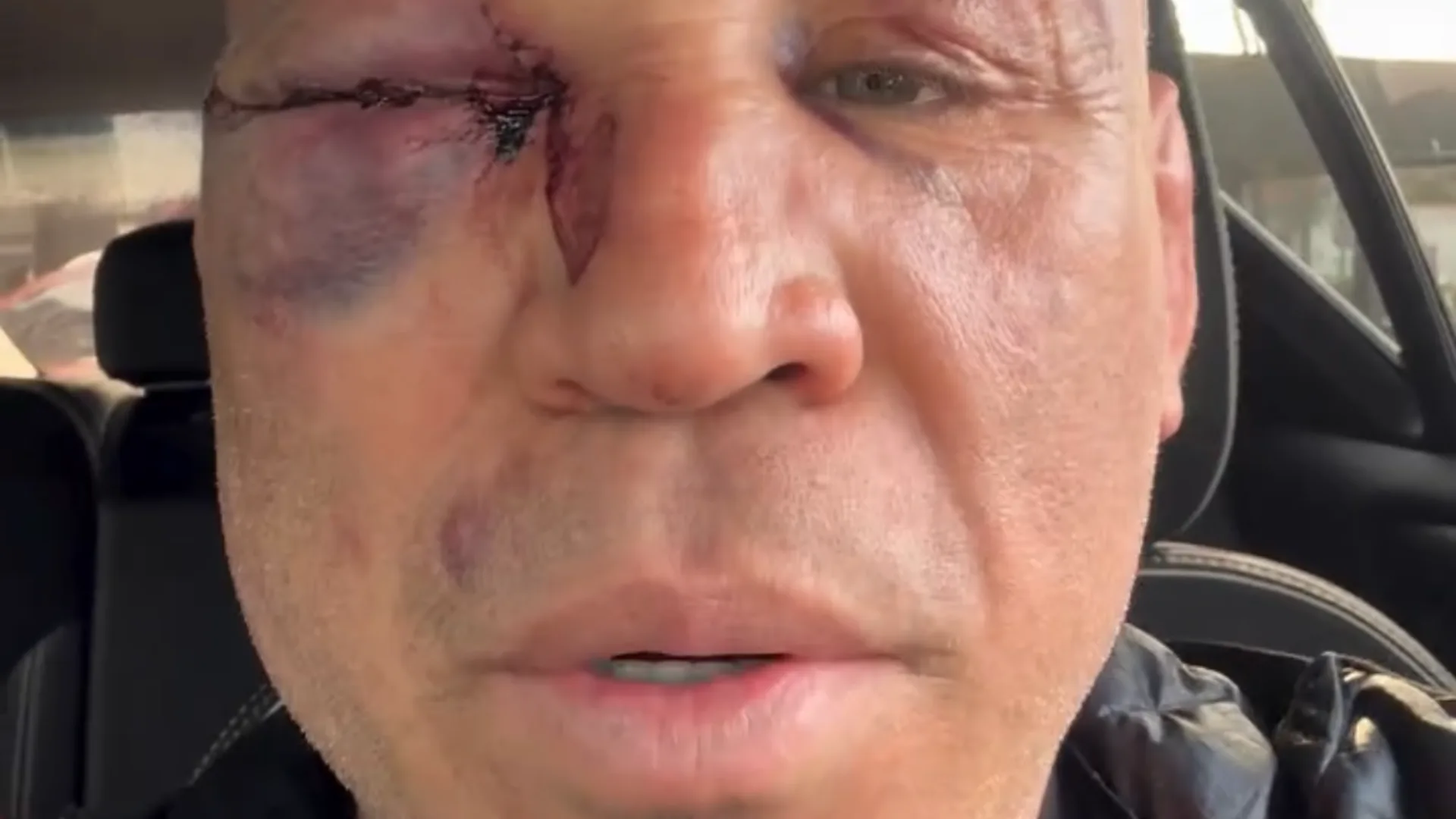 Wanderlei Silva acusa equipe de Popó após confusão em luta e relata tontura e dores de cabeça
