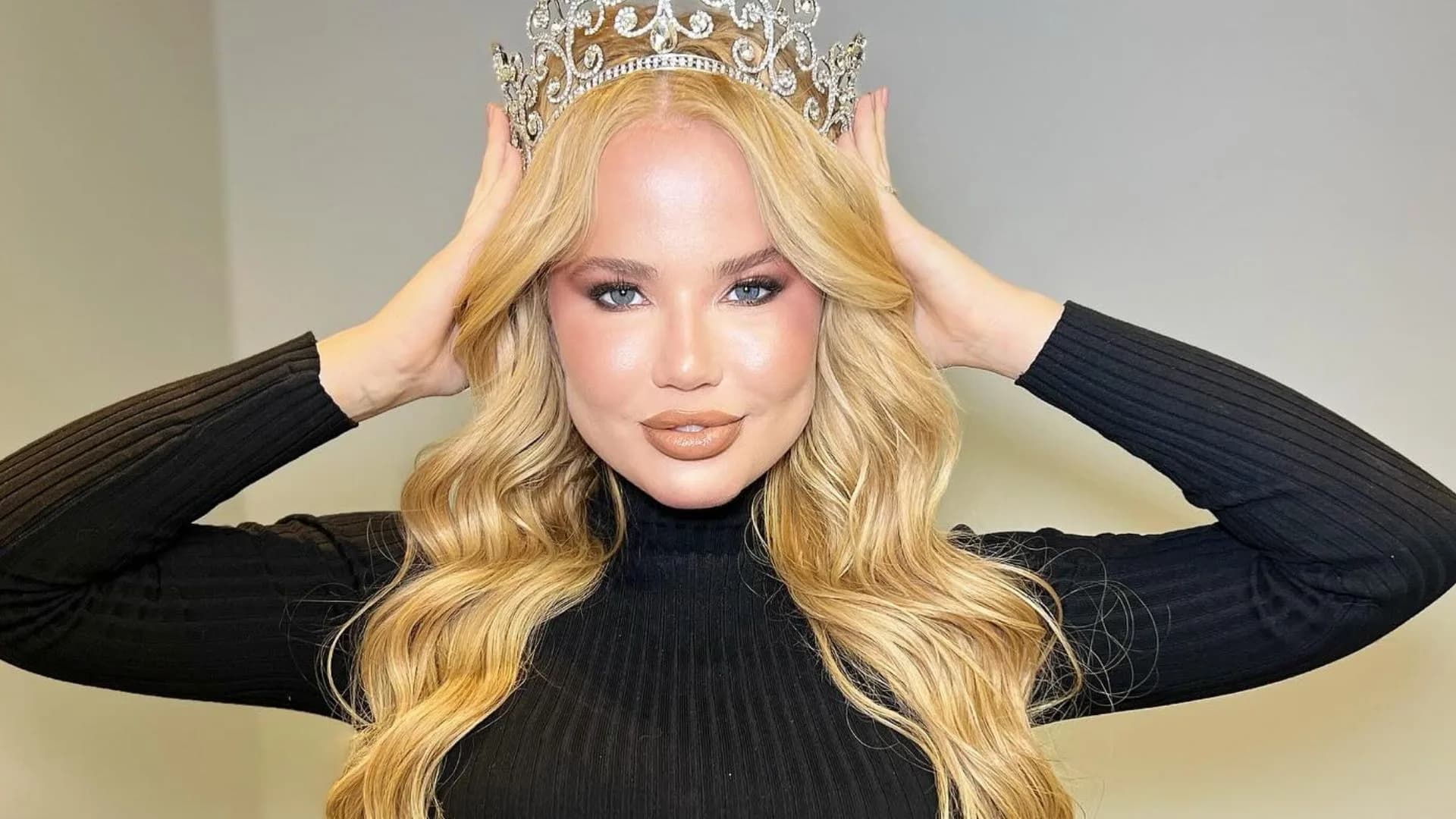 Namorada de Dado Dolabella volta a se pronunciar após rumores de agressão