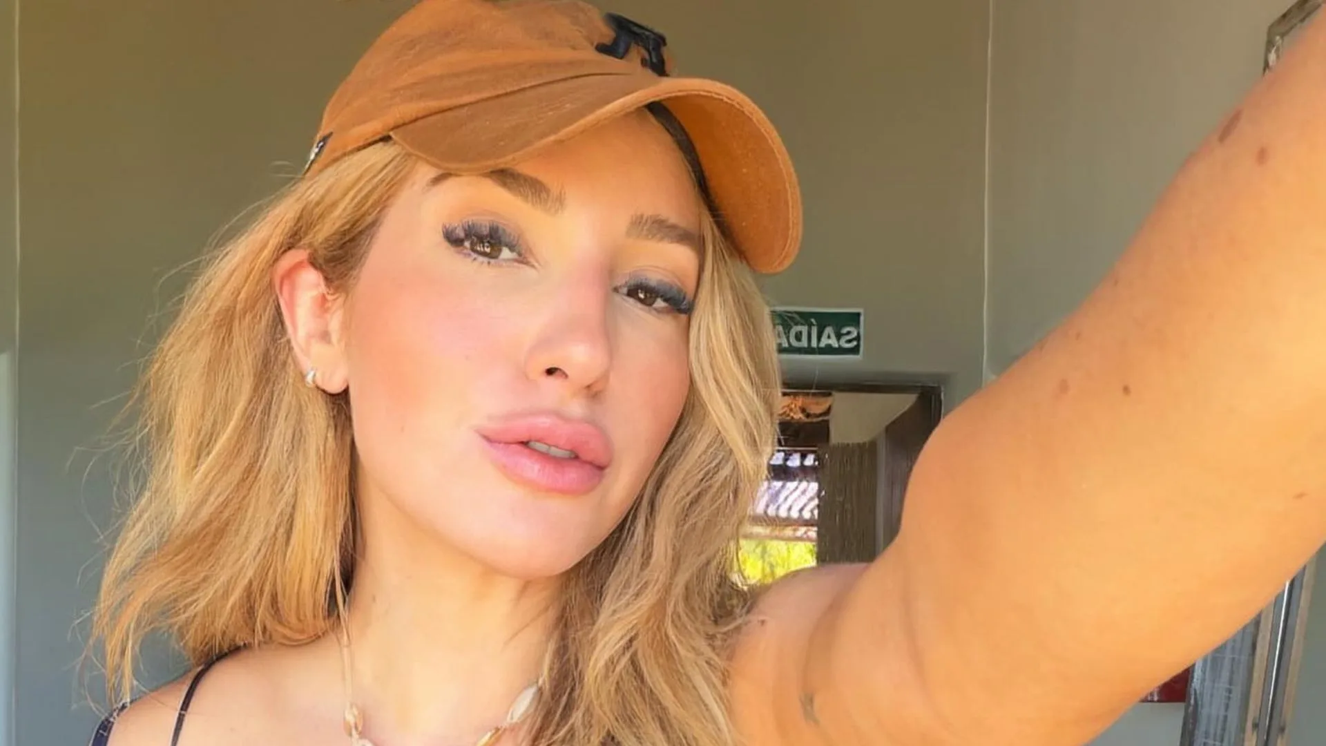 Ex-BBB Amanda Meirelles se pronuncia após ‘antes e depois’ repercutir