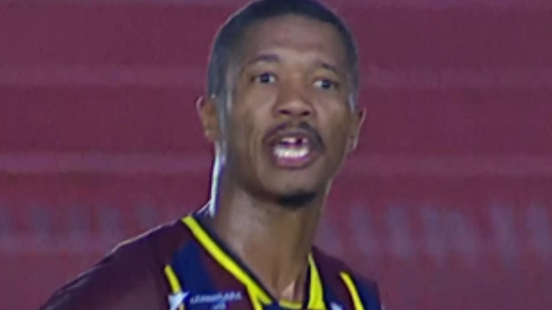 Jogador do Madureira perde o dente durante dividida em jogo