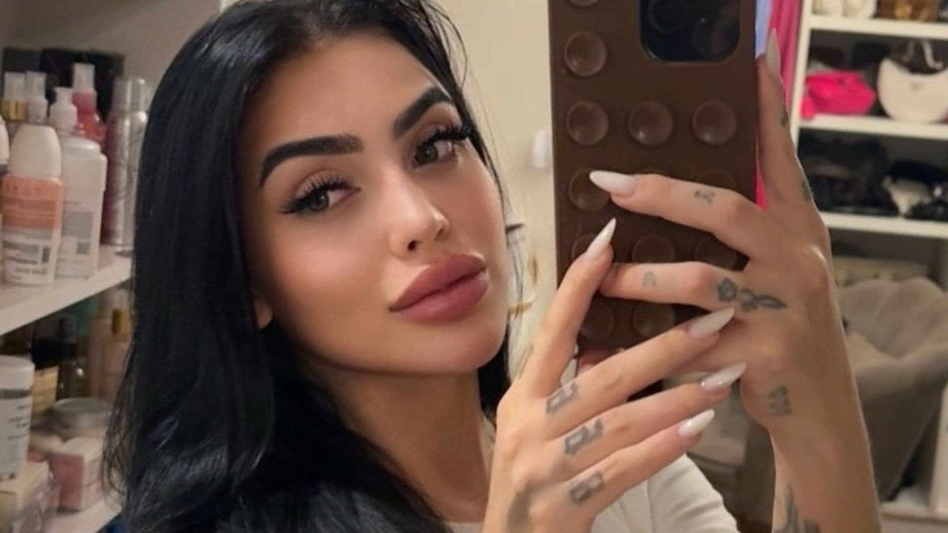 Antes e depois: Mirella exibe resultado de lipoescultura e explica procedimento
