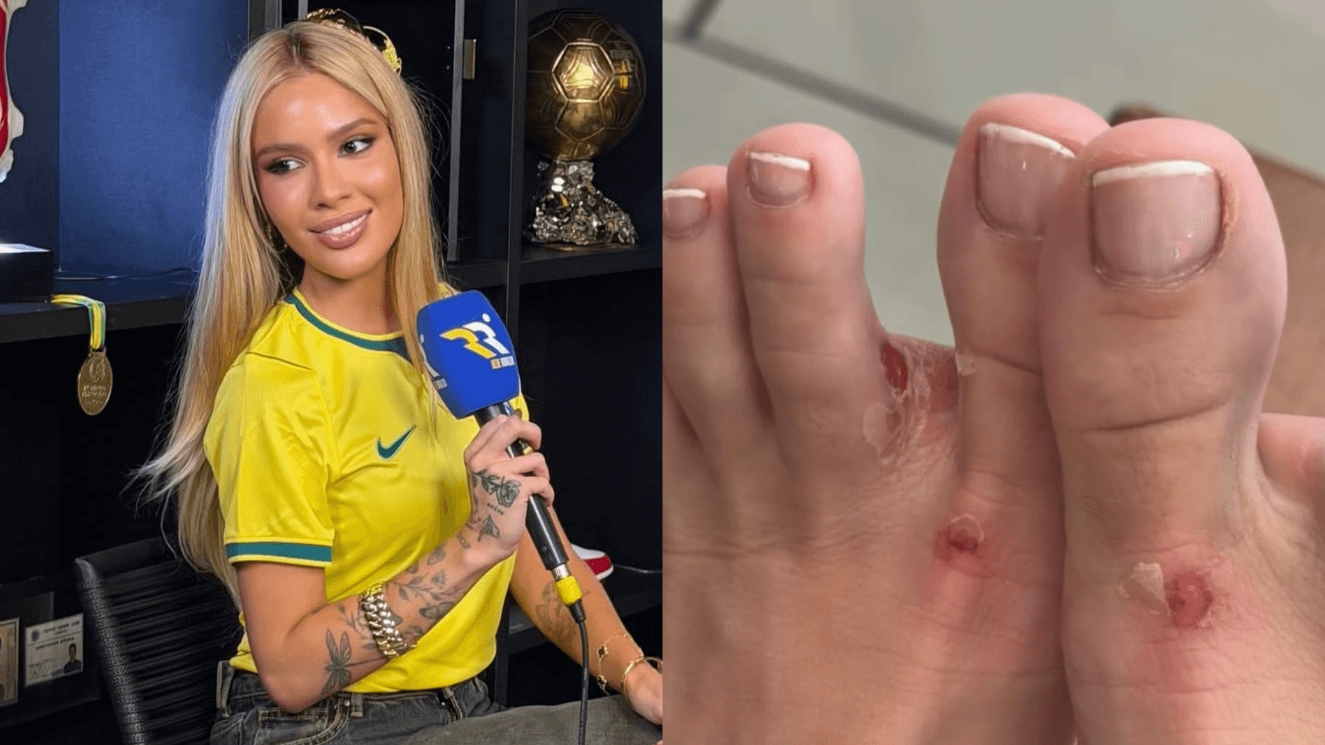 Karoline Lima mostra ferimentos nos pés após trabalhar na cobertura da Copa: “Não estou conseguindo andar”