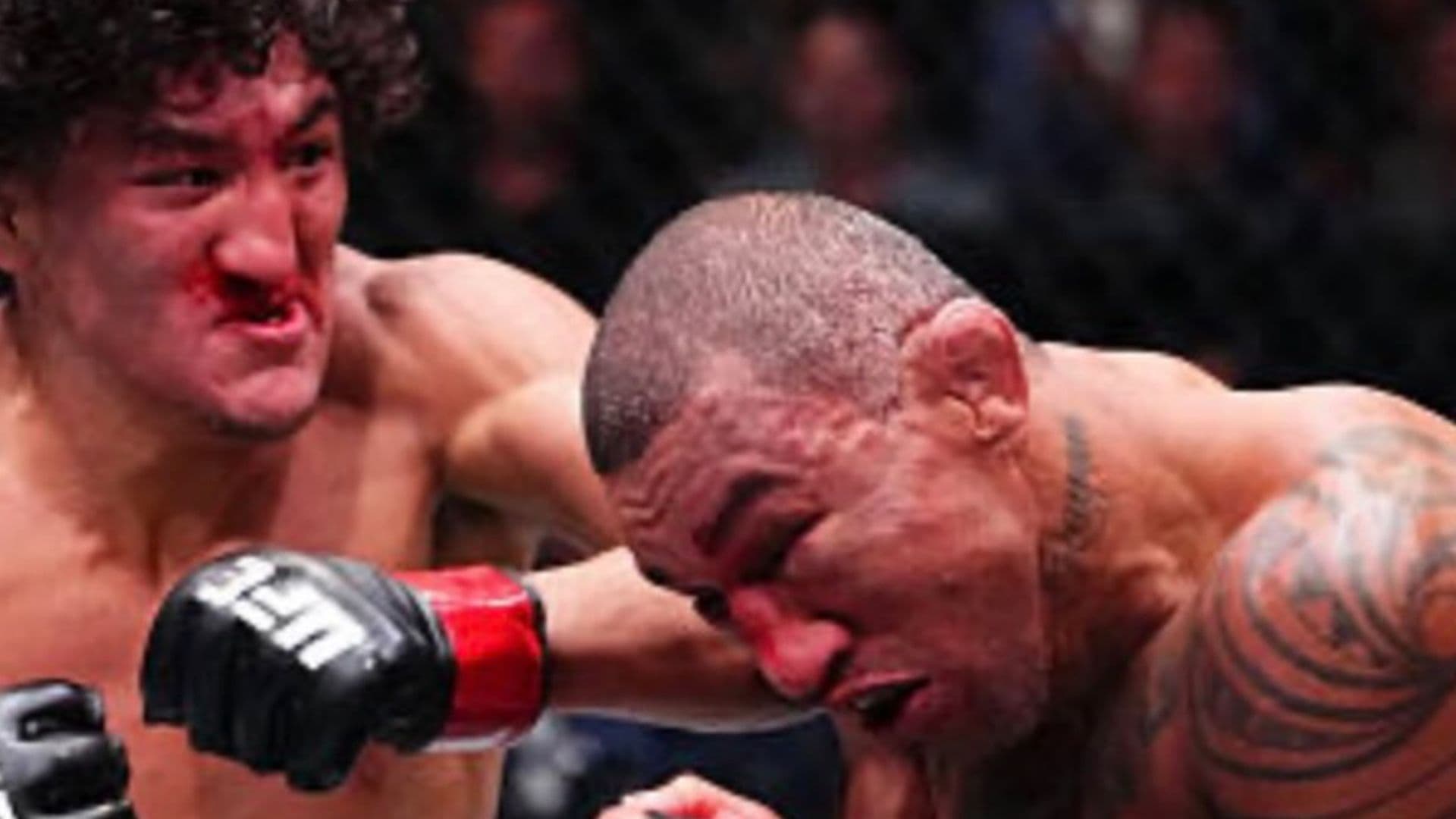 Imagens fortes: Lutador brasileiro sai de maca após confronto no UFC